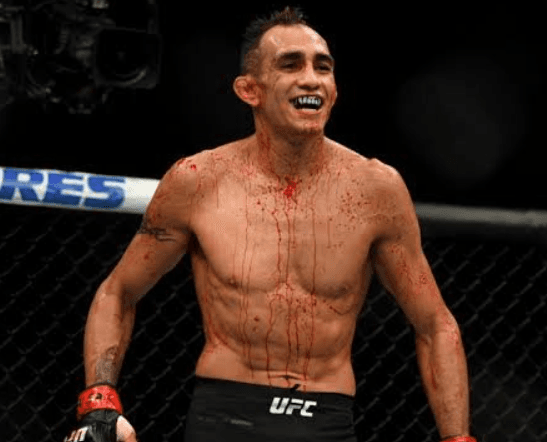 Tony Ferguson